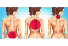 Back pain with symptoms in the legs