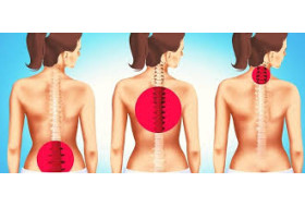 Back pain with symptoms in the legs